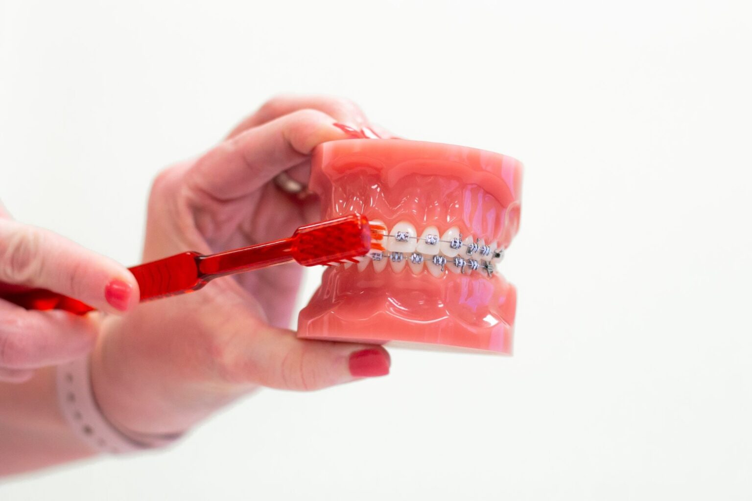 Orthodontic FAQ Holladay Braces Foothill Invisalign