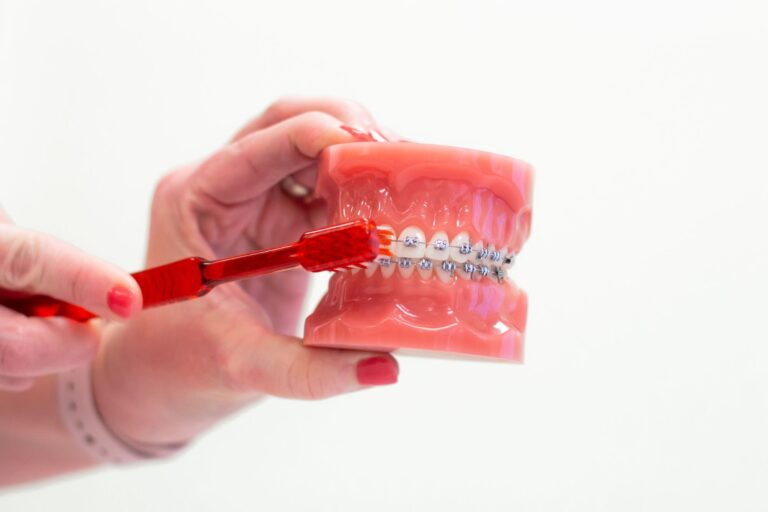 Orthodontic FAQ | Holladay Braces | Foothill Invisalign