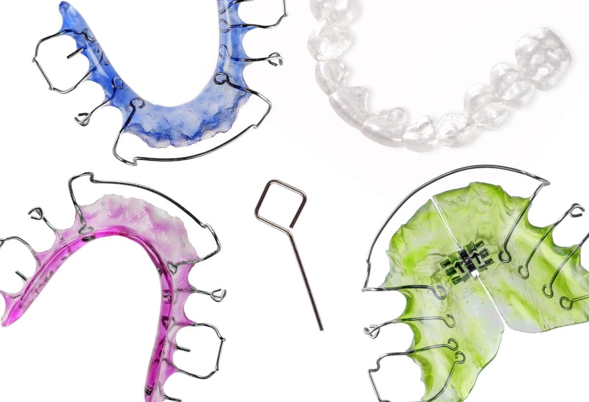 What You Need to Know About Palatal Expanders